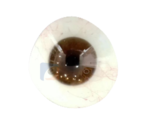 泰安进口义眼定制